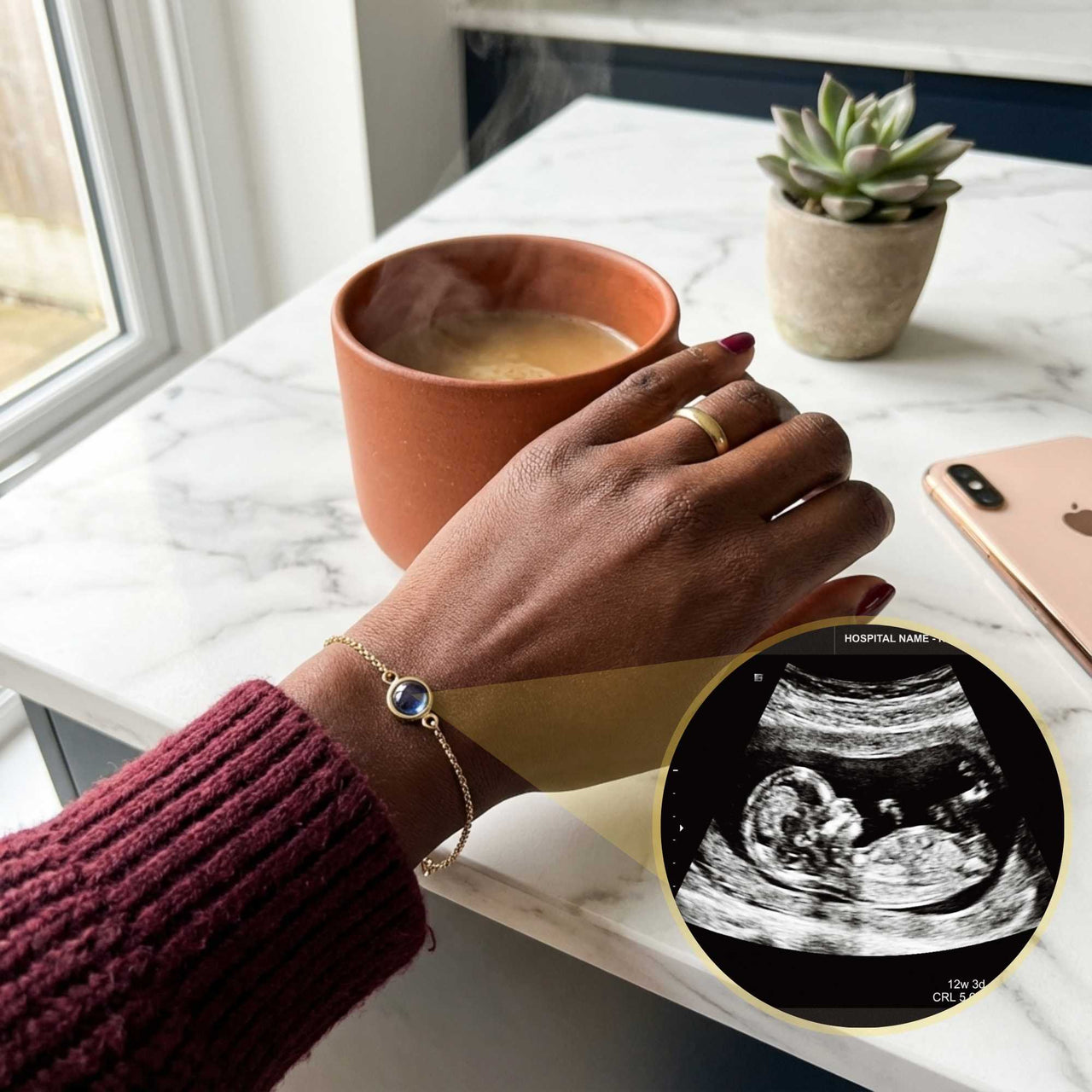 Photo Projection Bracelet - From Ultrasound to Forever